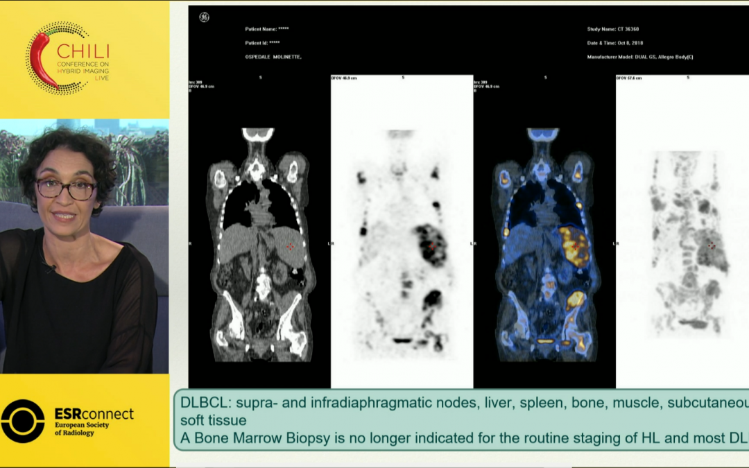 PET/CT in Lymphoma