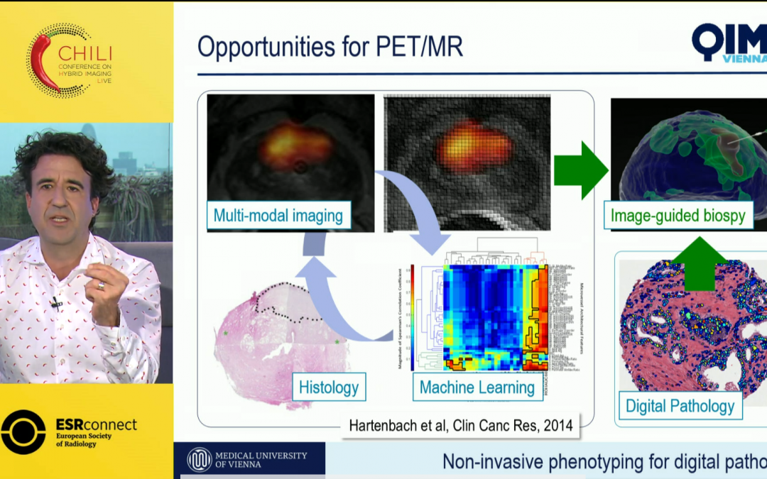 Combined PET/MRI: Methods & application