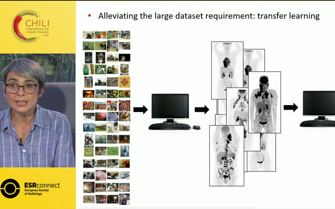 Artificial intelligence in hybrid imaging – The best of all worlds?