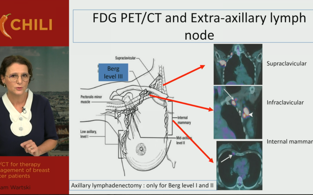 PET/CT for therapy management of breast cancer patients
