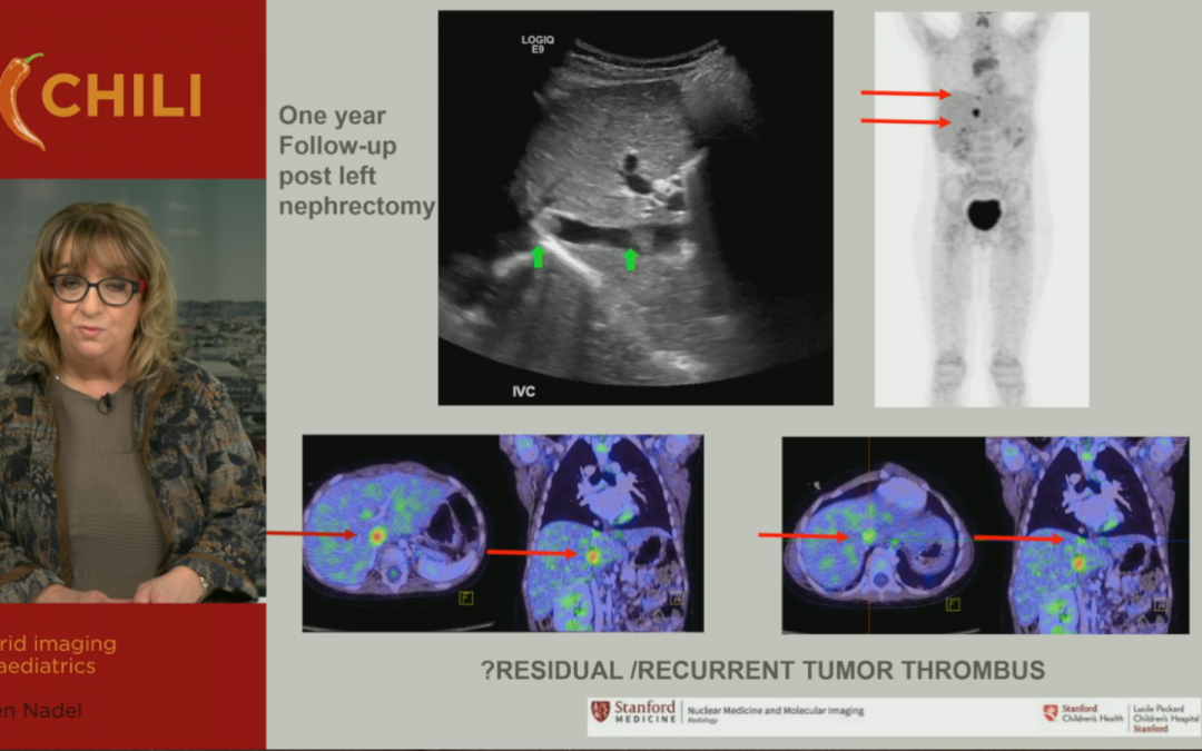 Hybrid imaging in paediatrics