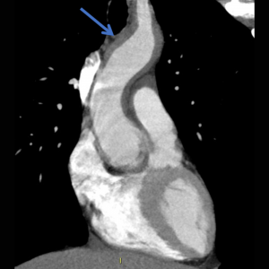 Fig. 1b