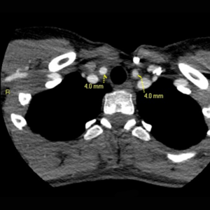 Fig. 1c