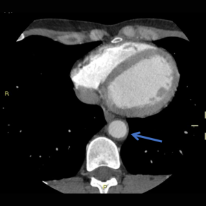 Fig. 1d